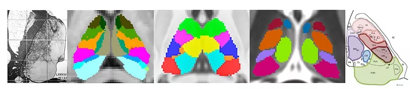 Thalamic Nuclei Imaging image